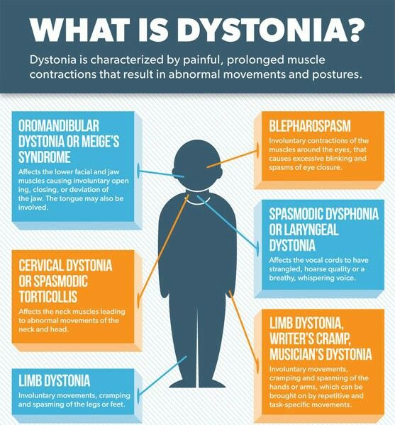 Pin by TiDubb on Dystonia 101